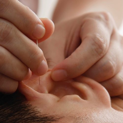 Acupuncture FAQ – Frequently Asked Questions