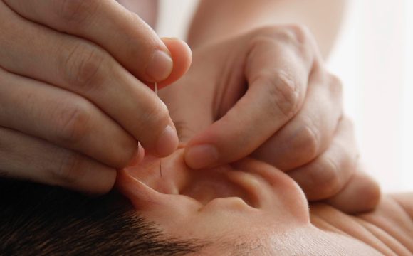 Acupuncture FAQ – Frequently Asked Questions