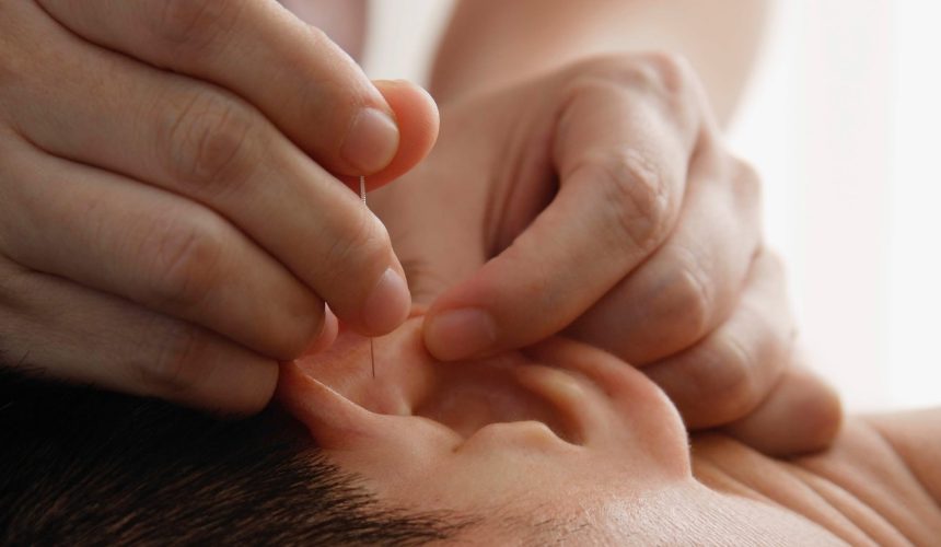 Acupuncture FAQ – Frequently Asked Questions